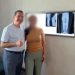 Tumor de células gigantes tratado con plastia con cemento óseo